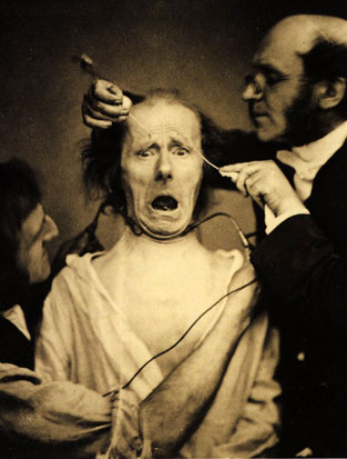 (dp) Duchenne de Boulogne, The Muscle of Fright, of Terror, 1862.