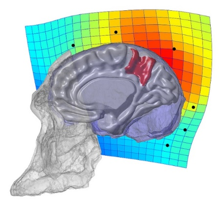 Figure 1. Digital model of skull and endocast of Australopithecus africanus, superimposed with a human brain (in red, the region of the medial parietal cortex corresponding to the precuneus). Behind, deformation mesh representing the expansion of the parietal region in modern humans. (cc) Emiliano Bruner.