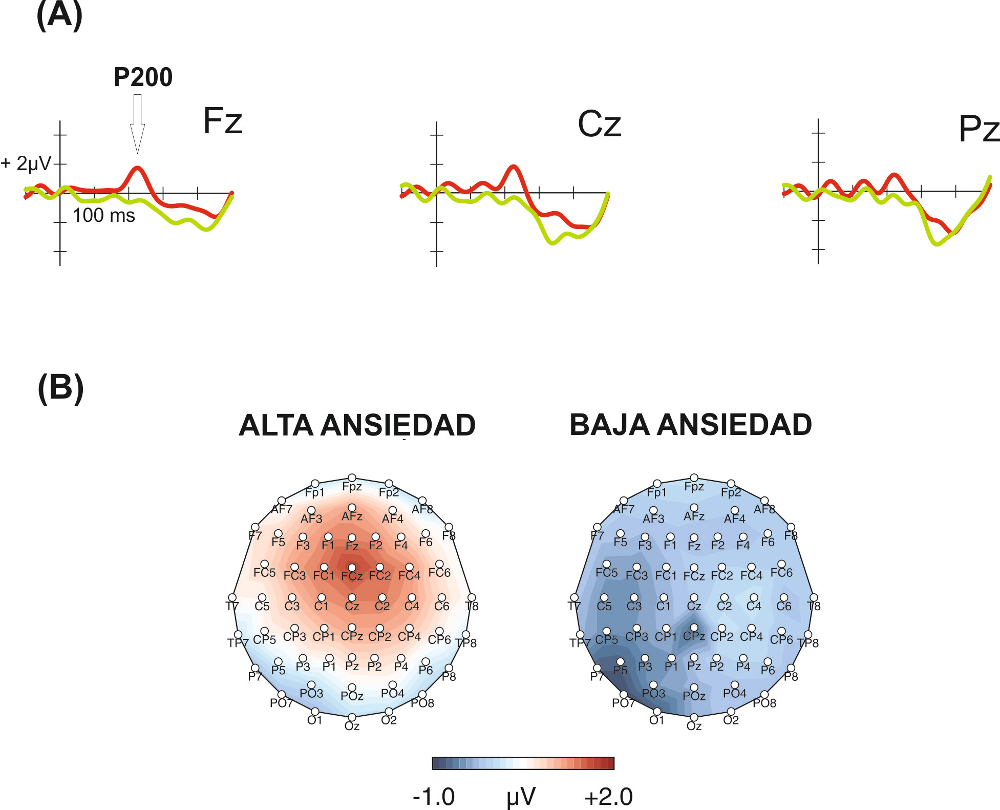 Figura 2.- Efecto de distancia en P200. A) Fluctuaciones de voltaje medidas por un electrodo frontal (Fz), uno central (Cz) y uno parietal (Pz), después de presentar el par de dígitos en la tarea de comparación numérica. Las líneas recogen la diferencia entre el voltaje medio registrado cuando los dígitos son cercanos y el registrado cuando son más lejanos (efecto de distancia) en el grupo con alta ansiedad matemática (rojo) y con baja ansiedad matemática (verde). Se aprecian visualmente las diferencias grupales en el pico que aparece a los 200 milisegundos (P200), huella fisiológica que acompaña al efecto de distancia, haciéndose patente en el grupo con alta ansiedad. B) Distribución espacial de este efecto fisiológico de distancia (rojo cuando es mayor) en el intervalo de 200-250 ms después de la presentación de los dígitos, en ambos grupos. Puede observarse que tal efecto se da en las personas con alta ansiedad matemática en electrodos frontocentrales.